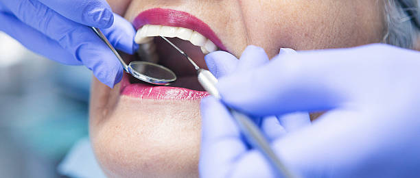 Best Emergency Tooth Extraction in Country Homes, WA